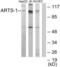 Endoplasmic Reticulum Aminopeptidase 1 antibody, abx013819, Abbexa, Western Blot image 