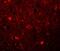 Sushi Repeat Containing Protein X-Linked antibody, NBP1-77086, Novus Biologicals, Immunofluorescence image 