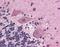 Neuroepithelial Cell Transforming 1 antibody, orb87578, Biorbyt, Immunohistochemistry paraffin image 