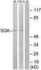 SGK antibody, TA314528, Origene, Western Blot image 
