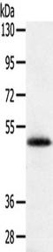 SPARC Related Modular Calcium Binding 2 antibody, TA351730, Origene, Western Blot image 