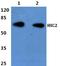 Hypermethylated in cancer 2 protein antibody, A10161, Boster Biological Technology, Western Blot image 