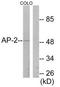 Transcription Factor AP-2 Alpha antibody, TA313238, Origene, Western Blot image 