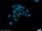 Radixin antibody, 13790-1-AP, Proteintech Group, Immunofluorescence image 