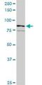 Ras guanyl-releasing protein 3 antibody, H00025780-D01P, Novus Biologicals, Western Blot image 