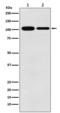 Minichromosome Maintenance Complex Component 3 antibody, M02580, Boster Biological Technology, Western Blot image 