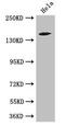 Trinucleotide Repeat Containing Adaptor 6C antibody, CSB-PA862070LA01HU, Cusabio, Western Blot image 