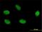 Zinc phosphodiesterase ELAC protein 2 antibody, H00060528-M01, Novus Biologicals, Immunocytochemistry image 