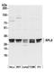 Ribosomal Protein L8 antibody, A305-059A, Bethyl Labs, Western Blot image 