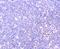 Pim-1 Proto-Oncogene, Serine/Threonine Kinase antibody, NBP2-67528, Novus Biologicals, Immunohistochemistry paraffin image 