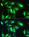 Valosin Containing Protein antibody, 14-951, ProSci, Immunofluorescence image 
