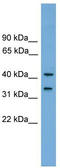 Family With Sequence Similarity 118 Member A antibody, TA335911, Origene, Western Blot image 