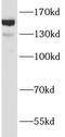Ankyrin Repeat Domain 11 antibody, FNab00405, FineTest, Western Blot image 