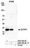 DCTP Pyrophosphatase 1 antibody, A305-795A-M, Bethyl Labs, Immunoprecipitation image 