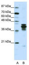 Heterogeneous nuclear ribonucleoprotein D0 antibody, TA345706, Origene, Western Blot image 