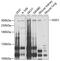 Nuclear Receptor Binding SET Domain Protein 1 antibody, GTX64684, GeneTex, Western Blot image 