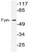 FYN Proto-Oncogene, Src Family Tyrosine Kinase antibody, AP21058PU-N, Origene, Western Blot image 