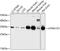 ATPase H+ Transporting V1 Subunit E1 antibody, GTX64545, GeneTex, Western Blot image 