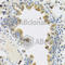 R-Spondin 1 antibody, A8289, ABclonal Technology, Immunohistochemistry paraffin image 