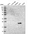 Gamma-Glutamyltransferase 1 antibody, HPA045635, Atlas Antibodies, Western Blot image 