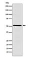 SWI/SNF Related, Matrix Associated, Actin Dependent Regulator Of Chromatin, Subfamily E, Member 1 antibody, M03739-1, Boster Biological Technology, Western Blot image 