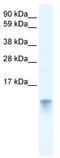 Fatty Acid Binding Protein 3 antibody, TA334289, Origene, Western Blot image 
