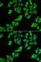 N(4)-(beta-N-acetylglucosaminyl)-L-asparaginase antibody, LS-C335656, Lifespan Biosciences, Immunofluorescence image 
