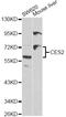 Carboxylesterase 2 antibody, A1514, ABclonal Technology, Western Blot image 