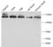 ATP Citrate Lyase antibody, FNab10354, FineTest, Western Blot image 