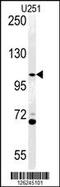 ArfGAP With Coiled-Coil, Ankyrin Repeat And PH Domains 3 antibody, 61-822, ProSci, Western Blot image 
