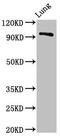 VPS16 Core Subunit Of CORVET And HOPS Complexes antibody, orb401084, Biorbyt, Western Blot image 