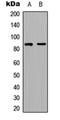 E3 ubiquitin-protein ligase RFWD3 antibody, orb304552, Biorbyt, Western Blot image 