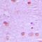 Nuclear Receptor Coactivator 7 antibody, orb215370, Biorbyt, Immunohistochemistry paraffin image 