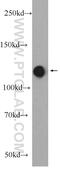 RNA Binding Motif Protein 25 antibody, 25297-1-AP, Proteintech Group, Western Blot image 