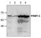 Protein Arginine Methyltransferase 5 antibody, TA319008, Origene, Western Blot image 