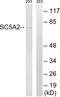 Sodium/glucose cotransporter 2 antibody, abx014900, Abbexa, Western Blot image 