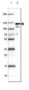 Amphiphysin antibody, NBP1-87561, Novus Biologicals, Western Blot image 