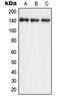 Nitric Oxide Synthase 3 antibody, LS-C352615, Lifespan Biosciences, Western Blot image 
