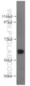 NLK antibody, 15171-1-AP, Proteintech Group, Western Blot image 
