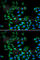 Cyclin-dependent kinase inhibitor 2A, isoforms 1/2/3 antibody, A0262, ABclonal Technology, Immunofluorescence image 