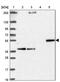 Sterol 26-hydroxylase, mitochondrial antibody, PA5-63674, Invitrogen Antibodies, Western Blot image 