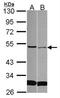 Secreted frizzled-related protein 4 antibody, NBP2-20330, Novus Biologicals, Western Blot image 