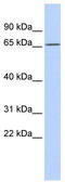 PR/SET Domain 8 antibody, TA337242, Origene, Western Blot image 