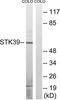 Serine/Threonine Kinase 39 antibody, TA326195, Origene, Western Blot image 