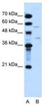 Dihydroorotate Dehydrogenase (Quinone) antibody, TA346288, Origene, Western Blot image 