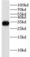 Glycine N-Methyltransferase antibody, FNab03550, FineTest, Western Blot image 