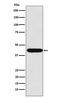 LIM Homeobox 2 antibody, M05940-3, Boster Biological Technology, Western Blot image 