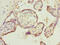 SH3 Domain Containing GRB2 Like 1, Endophilin A2 antibody, LS-C676478, Lifespan Biosciences, Immunohistochemistry paraffin image 