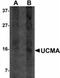 Upper Zone Of Growth Plate And Cartilage Matrix Associated antibody, NBP1-72115, Novus Biologicals, Western Blot image 