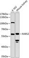 Arginyl-TRNA Synthetase 2, Mitochondrial antibody, A10485, Boster Biological Technology, Western Blot image 
